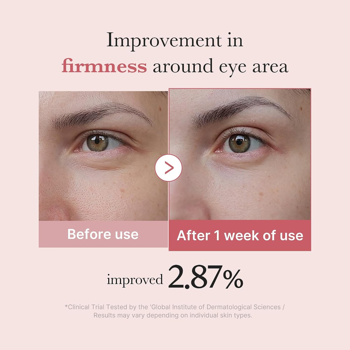Eye Cream with Salmon DNA PDRN & Pink Peptides | 99% Purity Retinol for Fine Lines