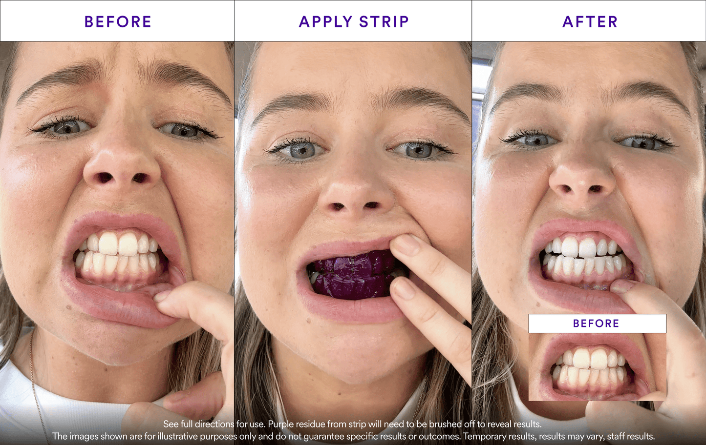 Affordable Whitening Set