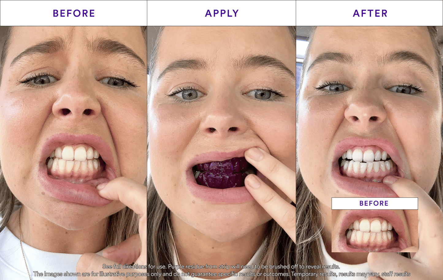 V34 Whitening Strips - Value 2 Pack